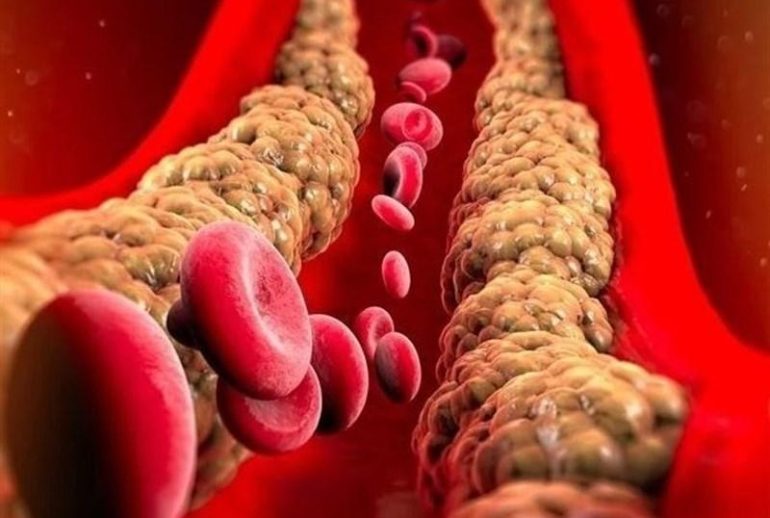 1734370645.89708_290884_image