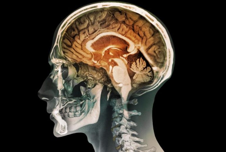 1734370667.056482_251266_image