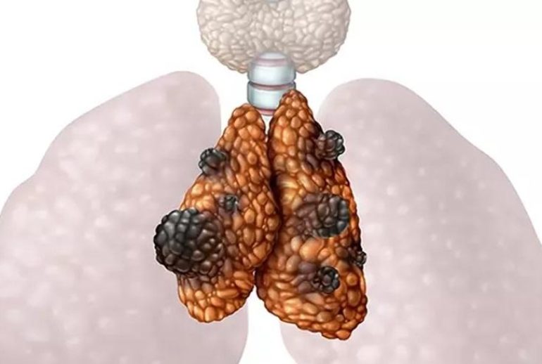 1734370710.793164_282390_image